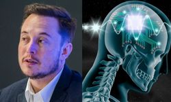 Neuralink nedir? Çılgın proje Neuralink ne demek? Elon Musk'ın çok konuşulan projesi Neuralink hakkında bilgiler