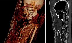 Bilgisayarlı tomografi Mısır’daki mumyaların sırlarını ortaya çıkardı