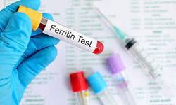 Ferritin Nedir? Ferritin Neden Yükselir? Ferritin Düşüklüğü Neden Olur?